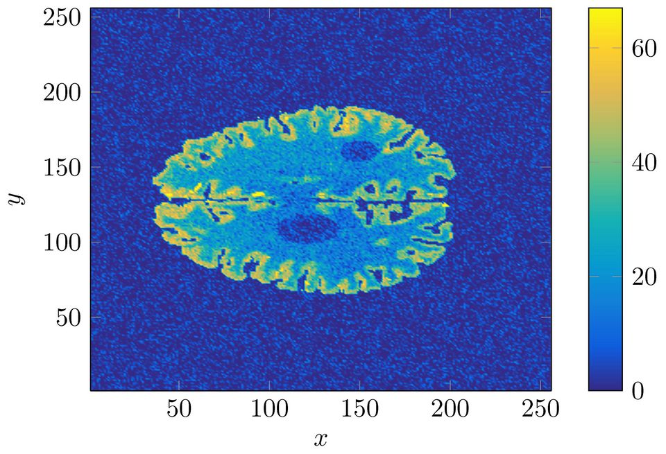 Estimate of probability for low perfusion.